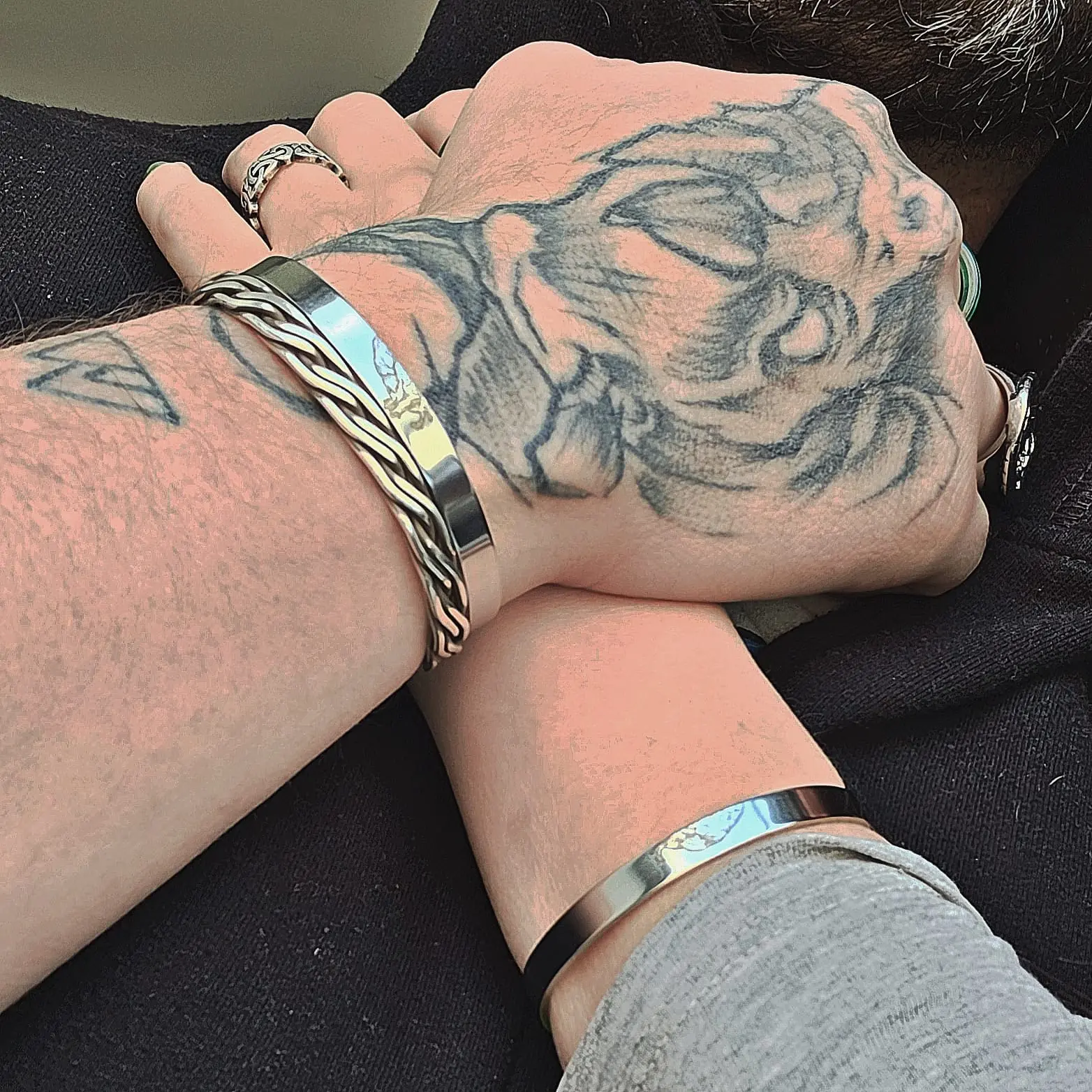 Cronica Brazalete (pareja)